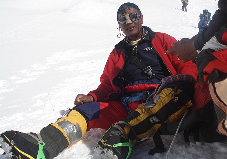 Everest summit challenges